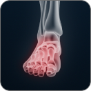 FOOT Image